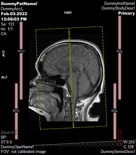 MRA & MRV OF BRAIN - AskRadiographerDotCom