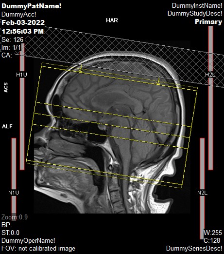 Mra And Mrv Of Brain Askradiographerdotcom 4380